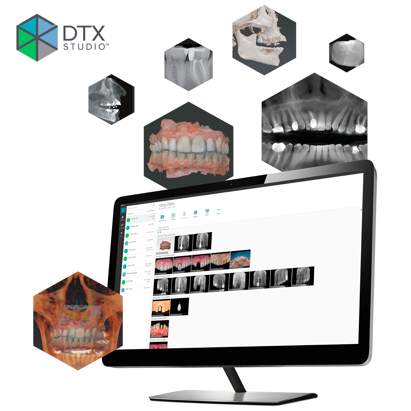 Программное обеспечение DTX STUDIO CLINIC DEXIS